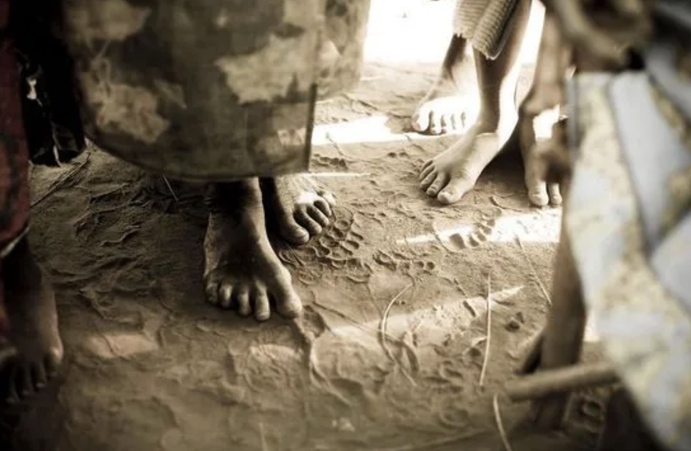 Chromoblastomycosis course thumbnail